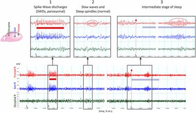 Sleep Disturbances in Rats With Genetic Pre-disposition to Spike-Wave Epilepsy (WAG/Rij)